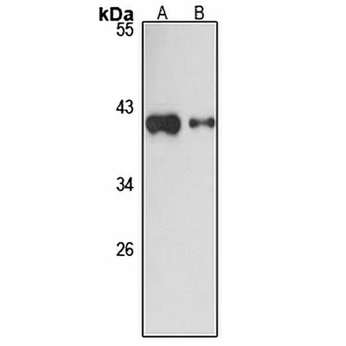 NOP17 Rabbit Polyclonal Antibody