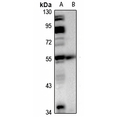 PI3K p85 gamma Rabbit Polyclonal Antibody