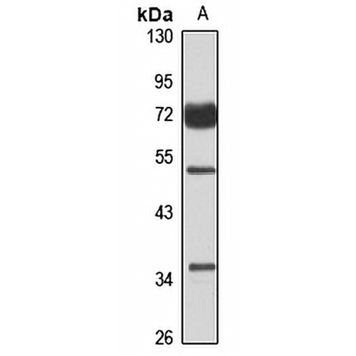 PIP5K1-beta Rabbit Polyclonal Antibody