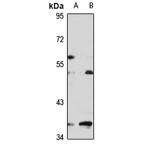 PISD Rabbit Polyclonal Antibody
