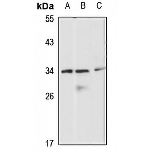 PITX3 Rabbit Polyclonal Antibody