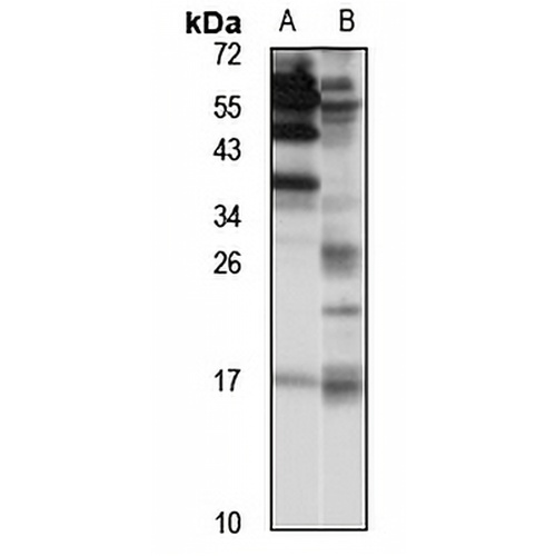PLA2G12A Rabbit Polyclonal Antibody