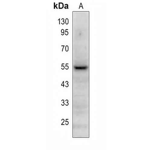 PLA2G7 Rabbit Polyclonal Antibody
