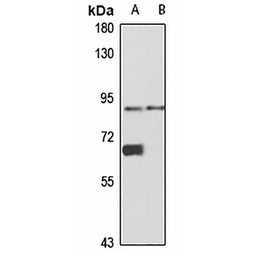 PLAP Rabbit Polyclonal Antibody