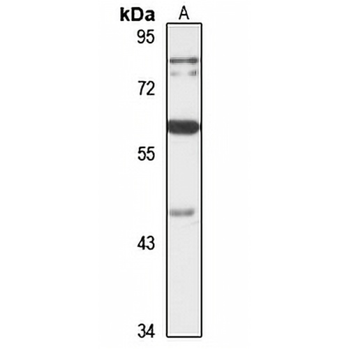 PLAGL2 Rabbit Polyclonal Antibody
