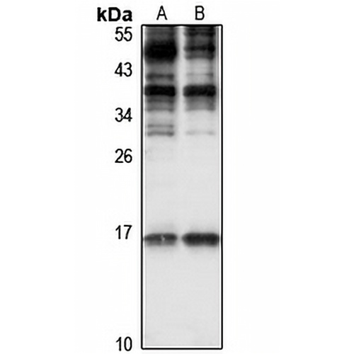 EVT-2 Rabbit Polyclonal Antibody