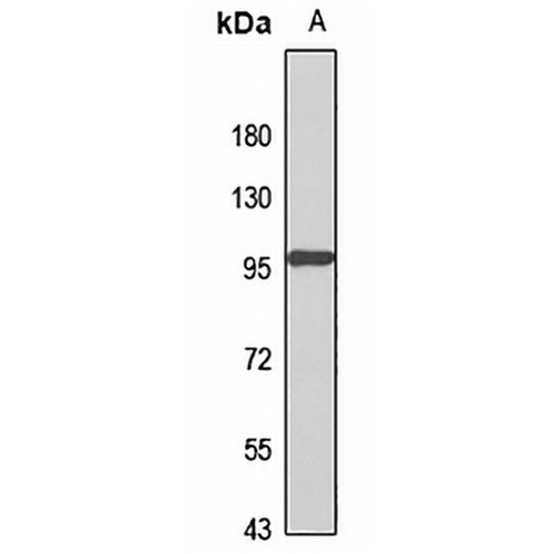 PLOD2 Rabbit Polyclonal Antibody