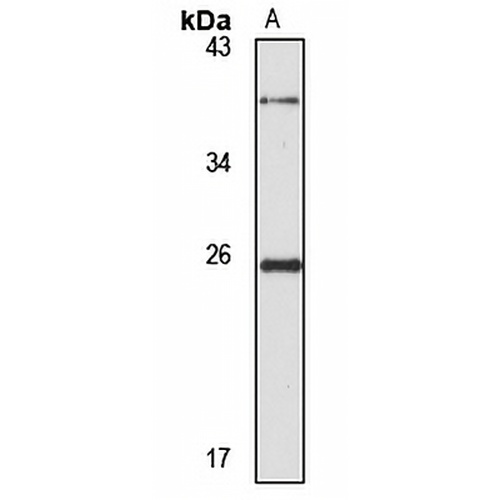 PMF-1 Rabbit Polyclonal Antibody