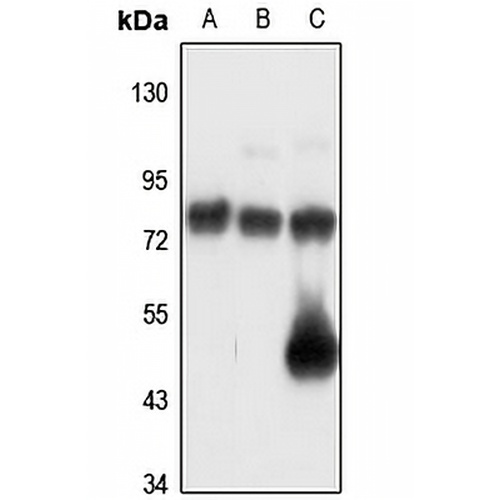 POMGNT2 Rabbit Polyclonal Antibody