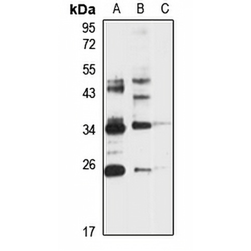 PPC Synthetase Rabbit Polyclonal Antibody