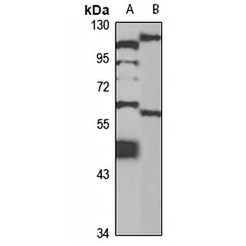 WIP1 Rabbit Polyclonal Antibody