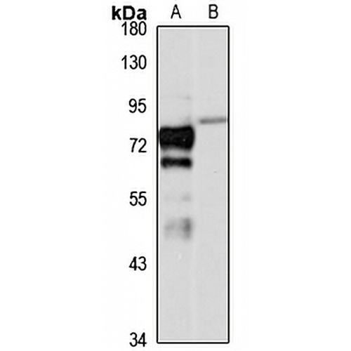 PP2C-gamma Rabbit Polyclonal Antibody