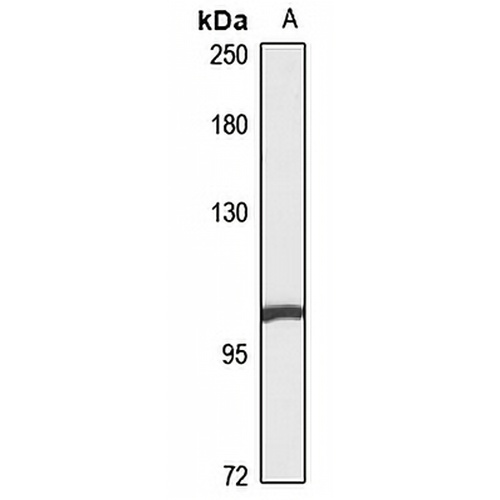 MYPT2 Rabbit Polyclonal Antibody