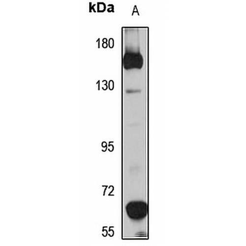 PPP1R3A Rabbit Polyclonal Antibody