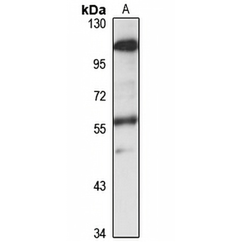 PPP2R5B Rabbit Polyclonal Antibody