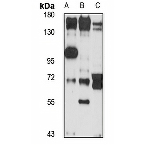 PP6R3 Rabbit Polyclonal Antibody