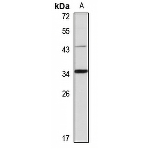 PPT2 Rabbit Polyclonal Antibody