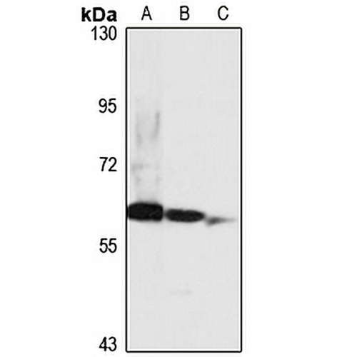 PRAME Rabbit Polyclonal Antibody
