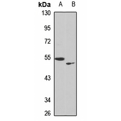 PRAMEF20/21 Rabbit Polyclonal Antibody