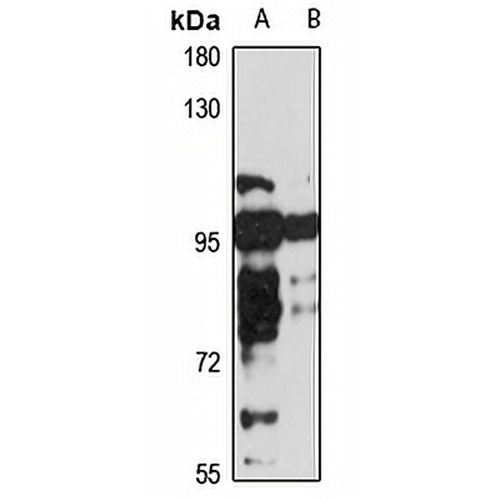PRDM1 Rabbit Polyclonal Antibody