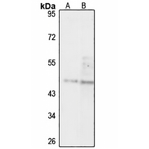 PREB Rabbit Polyclonal Antibody