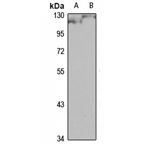 PRICKLE2 Rabbit Polyclonal Antibody