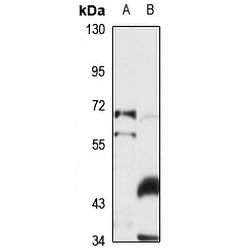 Prolactin Receptor Rabbit Polyclonal Antibody