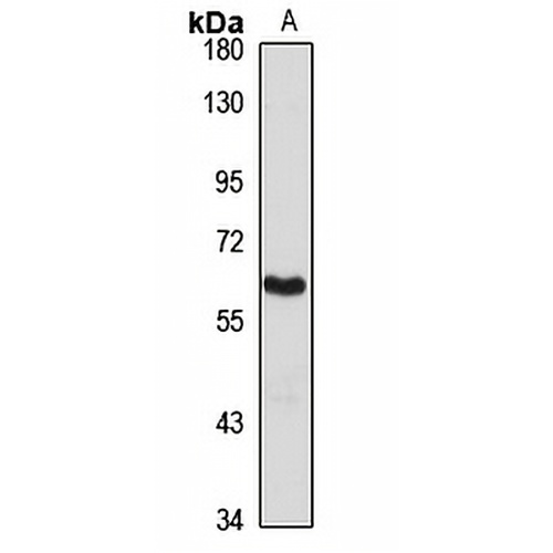 PRMT3 Rabbit Polyclonal Antibody