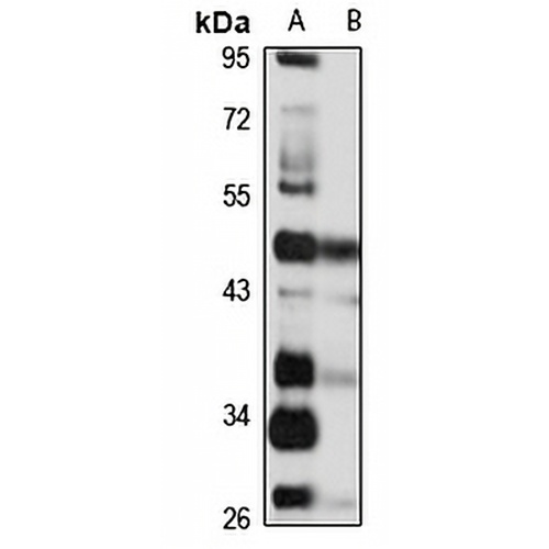 GPR73b Rabbit Polyclonal Antibody