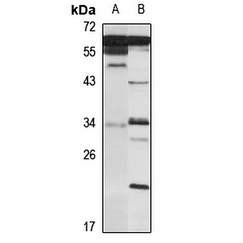 PRRT2 Rabbit Polyclonal Antibody