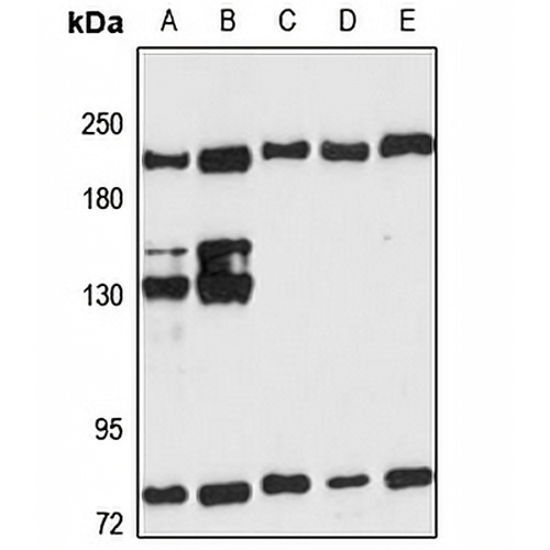 PSME4 Rabbit Polyclonal Antibody