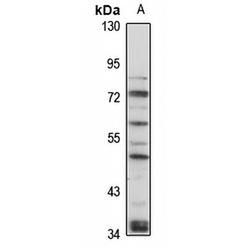 PTH2R Rabbit Polyclonal Antibody