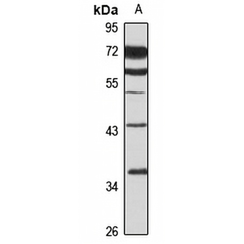 HePTP Rabbit Polyclonal Antibody