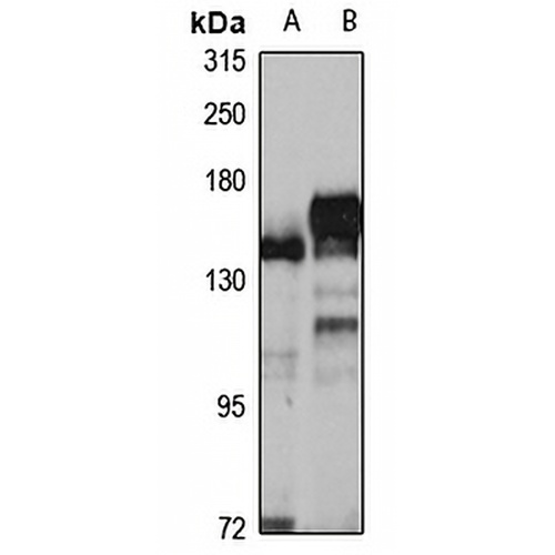 LAR Rabbit Polyclonal Antibody