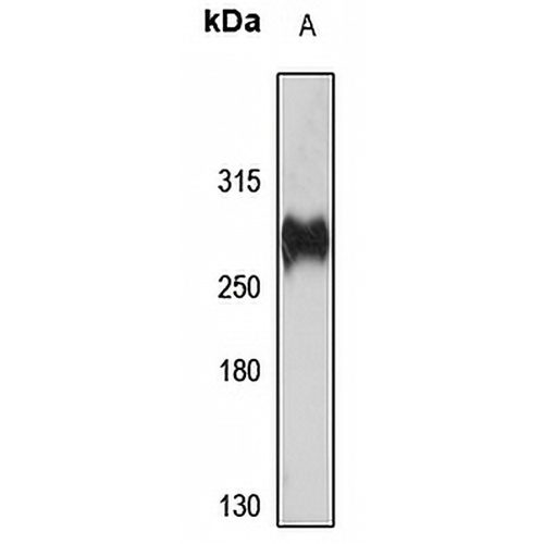 CD148 Rabbit Polyclonal Antibody