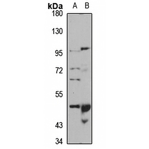 PTPRR Rabbit Polyclonal Antibody