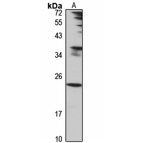 PTRH1 Rabbit Polyclonal Antibody