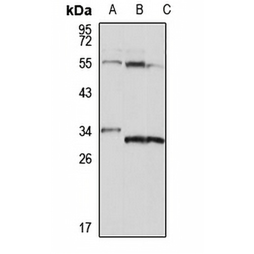 PYCR2 Rabbit Polyclonal Antibody