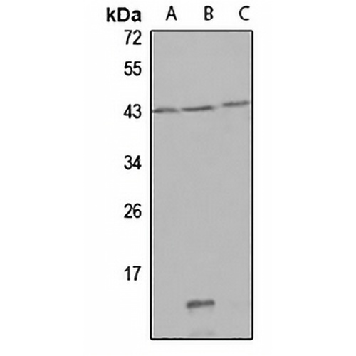 QPCT Rabbit Polyclonal Antibody