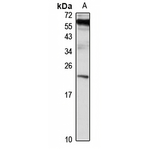 RAB10 Rabbit Polyclonal Antibody
