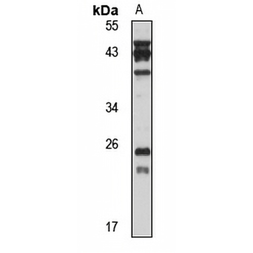 RAB28 Rabbit Polyclonal Antibody