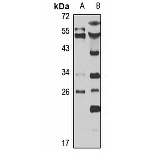 Rab 4A Rabbit Polyclonal Antibody