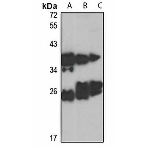 RAB5B Rabbit Polyclonal Antibody