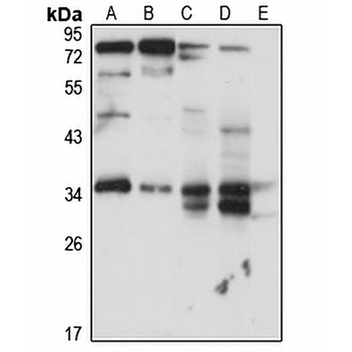 RABGGTB Rabbit Polyclonal Antibody