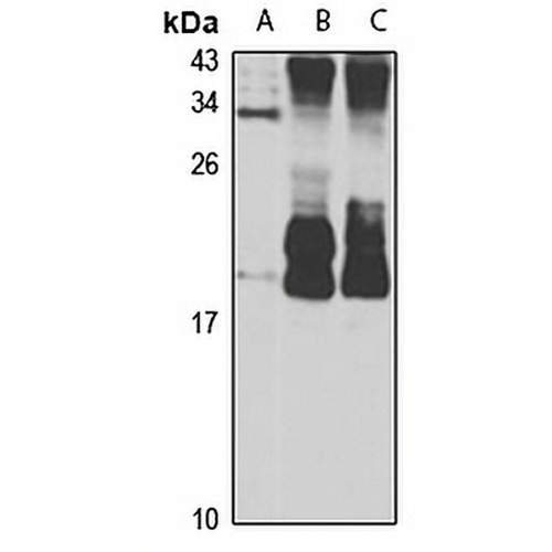 RAC3 Rabbit Polyclonal Antibody
