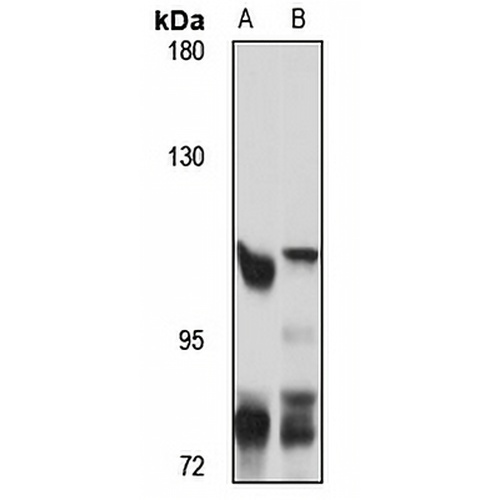 RAD54B Rabbit Polyclonal Antibody