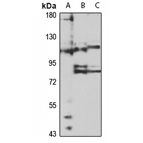 EPAC2 Rabbit Polyclonal Antibody