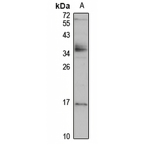 TIG3 Rabbit Polyclonal Antibody