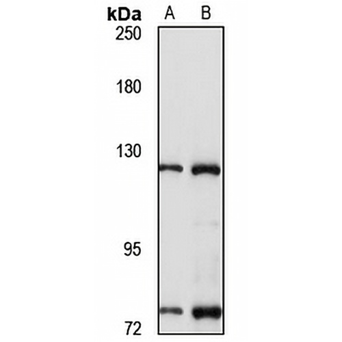 RASA1 Rabbit Polyclonal Antibody