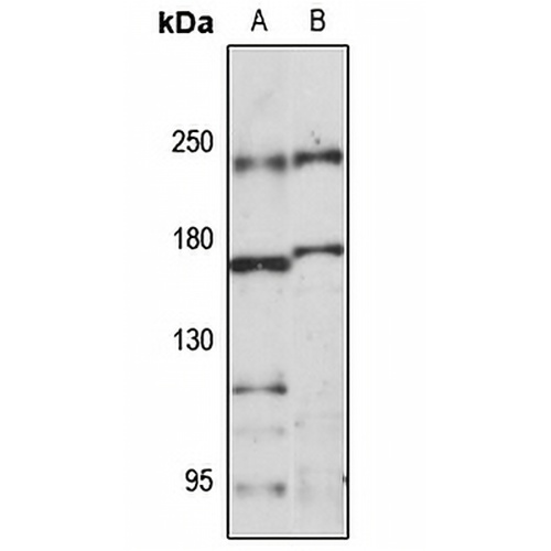 RB1CC1 Rabbit Polyclonal Antibody